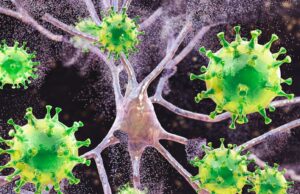 Measles Is Causing Brain Swelling in Children in South Carolina