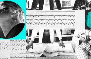 Technology Is Reshaping Sleep Apnea Treatment