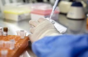 Supercharging Immune Cells May Help Control HIV Long-Term